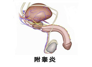 附睾炎,阜阳附睾炎,阜阳附睾炎原因